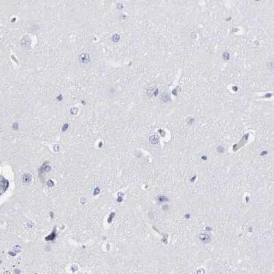 Immunohistochemistry-Paraffin: Decorin Antibody [NBP1-84970]