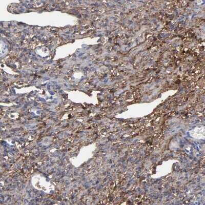 Immunohistochemistry-Paraffin: Decorin Antibody [NBP1-84970]