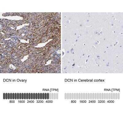 Immunohistochemistry-Paraffin: Decorin Antibody [NBP1-84970]