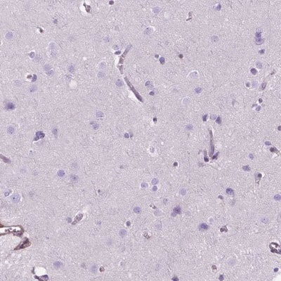 Immunohistochemistry-Paraffin: Decorin Antibody [NBP2-56346]