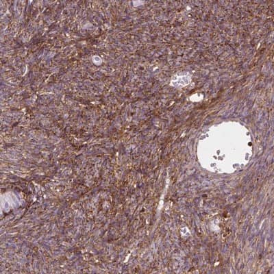 Immunohistochemistry-Paraffin: Decorin Antibody [NBP2-56346]
