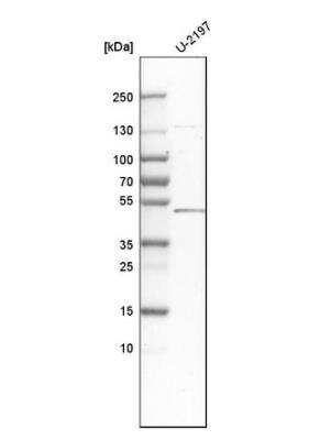 Western Blot: Decorin Antibody [NBP1-84970]