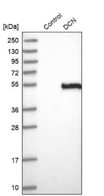 Western Blot: Decorin Antibody [NBP1-84970]