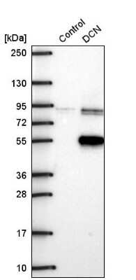 Western Blot: Decorin Antibody [NBP2-56346]