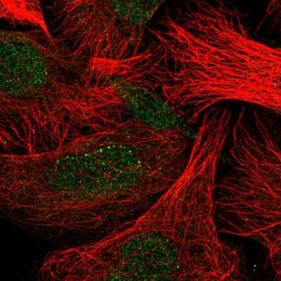 Immunocytochemistry/ Immunofluorescence: Dectin-1/CLEC7A Antibody [NBP2-55630]