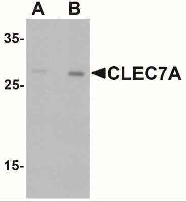 Western Blot: Dectin-1/CLEC7A AntibodyBSA Free [NBP2-41170]