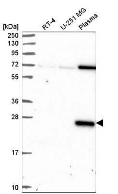 Western Blot: Dectin-1/CLEC7A Antibody [NBP2-55630]