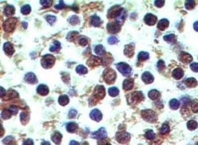 Immunohistochemistry: Dectin-2/CLEC6A Antibody (3D1) - Azide and BSA Free [NBP2-36486]