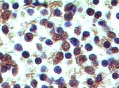 Immunohistochemistry-Paraffin: Dectin-2/CLEC6A Antibody (3D1) - BSA Free [NBP2-27159]