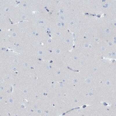 Immunohistochemistry-Paraffin: Defensin alpha 4 Antibody [NBP2-13910]