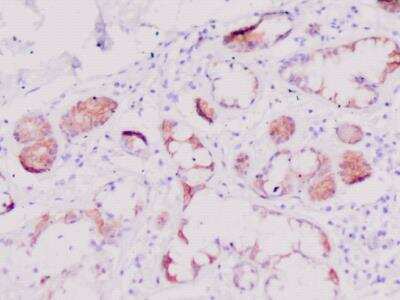 Immunohistochemistry-Paraffin: Defensin beta 2 Antibody [NBP3-11287]