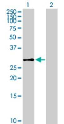 Western Blot: Dehydrodolichyl Diphosphate Synthase Antibody [H00079947-B01P]