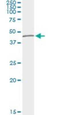 Immunoprecipitation: Delta 1 Tubulin Antibody (3C7) [H00051174-M05]