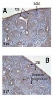 Immunohistochemistry: Delta Np73 Antibody (38C674.2) - Azide and BSA Free [NBP2-33262]