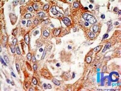 Immunohistochemistry-Paraffin: Delta Np73 Antibody (38C674.2) - Azide and BSA Free [NBP2-33262]