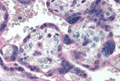 Immunohistochemistry-Paraffin: Delta Np73 Antibody (38C674.2) - Azide and BSA Free [NBP2-33262]