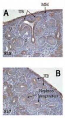 Immunohistochemistry-Frozen: Delta Np73 Antibody (38C674.2) [NBP2-24873]