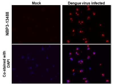 Immunohistochemistry-Paraffin: Dengue Virus 2 Envelope Antibody (GT643) [NBP3-13488]