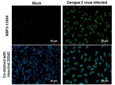 Immunocytochemistry/ Immunofluorescence: Dengue Virus NS1 protein Antibody (GT1061) [NBP3-13504]