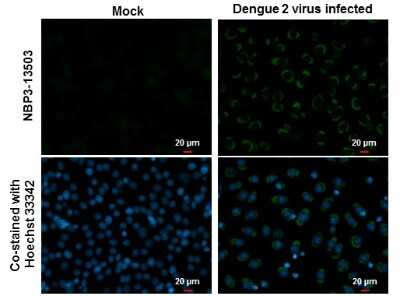 Immunocytochemistry/ Immunofluorescence: Dengue Virus NS1 protein Antibody (GT4212) [NBP3-13503]