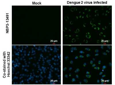 Immunocytochemistry/ Immunofluorescence: Dengue Virus NS3 Antibody (GT2811) [NBP3-13491]