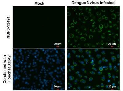 Immunocytochemistry/ Immunofluorescence: Dengue Virus NS3 Antibody (GT2811) [NBP3-13491]