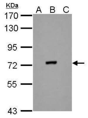 Western Blot: Dengue Virus NS3 Antibody (GT2811) [NBP3-13491]