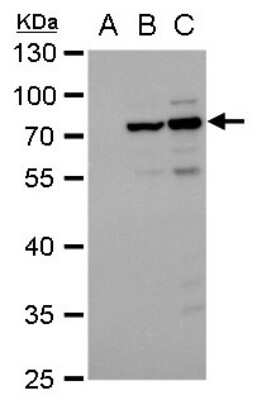 Western Blot: Dengue Virus NS3 Antibody (GT2811) [NBP3-13491]