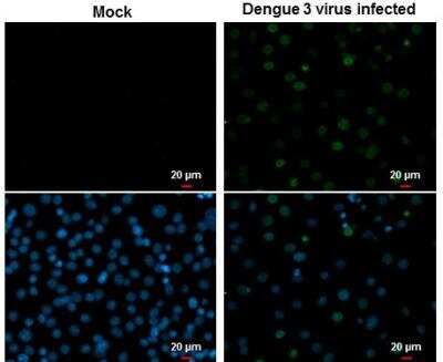 Immunocytochemistry/ Immunofluorescence: Dengue Virus NS5 Antibody [NBP2-42901]