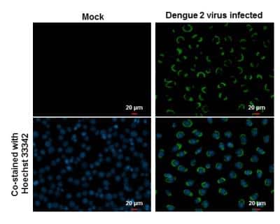 Immunocytochemistry/ Immunofluorescence: Dengue Virus NS1 protein Antibody [NBP2-54602]