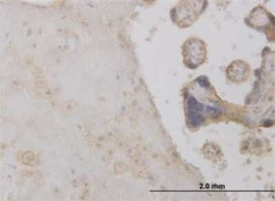 Immunohistochemistry-Paraffin: Deoxycytidylate deaminase Antibody (4B9) [H00001635-M01]