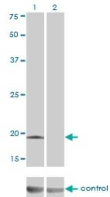 Western Blot: Deoxycytidylate deaminase Antibody (4B9) [H00001635-M01]