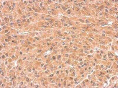 Immunohistochemistry-Paraffin: Deoxycytidylate deaminase Antibody [NBP2-16149]