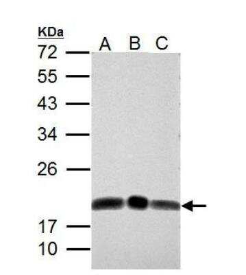Western Blot: Deoxycytidylate deaminase Antibody [NBP2-16149]