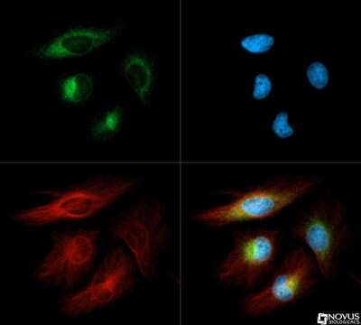 Immunocytochemistry/ Immunofluorescence: Derlin 1 Antibody [NB100-448]