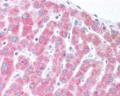 Immunohistochemistry: Derlin 1 Antibody [NB100-448]