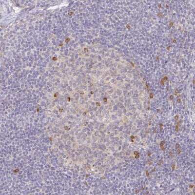 Immunohistochemistry: Derlin-2 Antibody [NBP2-49231]