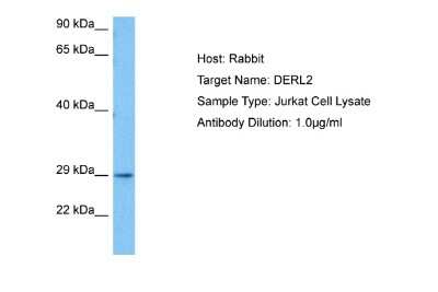 Western Blot: Derlin-2 Antibody [NBP2-84780]