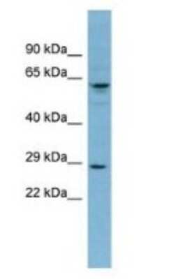 Western Blot: Derlin-3 Antibody [NBP1-59466]