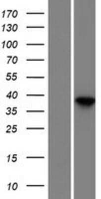 Western Blot: Dermokine beta Overexpression Lysate [NBP2-11393]
