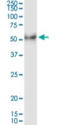Western Blot: Desert Hedgehog/Dhh Antibody (2D5) [H00050846-M02]
