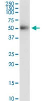 Western Blot: Desert Hedgehog/Dhh Antibody (3E6) [H00050846-M03]