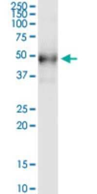 Western Blot: Desert Hedgehog/Dhh Antibody (4F10) [H00050846-M01]