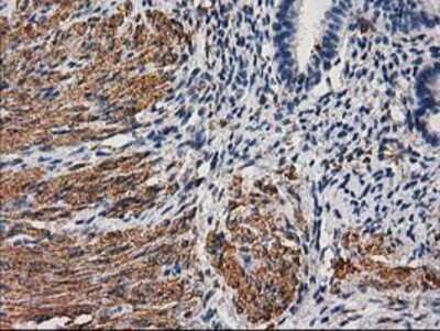 Immunohistochemistry-Paraffin: Desmin Antibody (OTI4G1) [NBP2-03539]