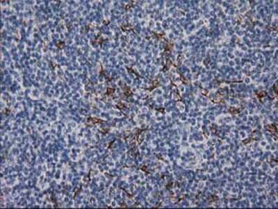 Immunohistochemistry-Paraffin: Desmin Antibody (OTI4G1) [NBP2-03539]