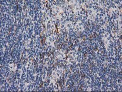 Immunohistochemistry-Paraffin: Desmin Antibody (OTI4G1) [NBP2-03539]