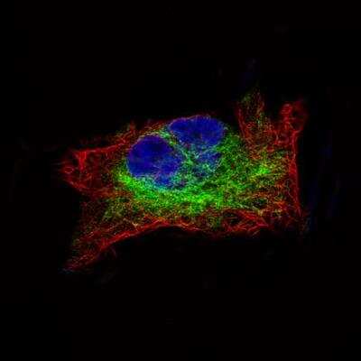 Immunocytochemistry/ Immunofluorescence: Desmin Antibody (CL4501) [NBP2-59055]