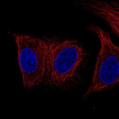 Immunocytochemistry/ Immunofluorescence: Desmin Antibody (CL4502) [NBP2-59056]