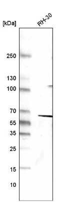 Western Blot: Desmin Antibody (CL4502) [NBP2-59056]