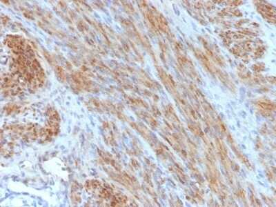 Immunohistochemistry-Paraffin: Desmin Antibody (DES/1711) [NBP2-53383]